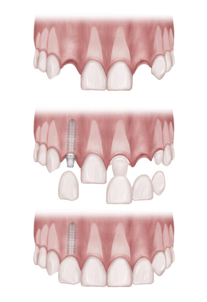 set2_9new